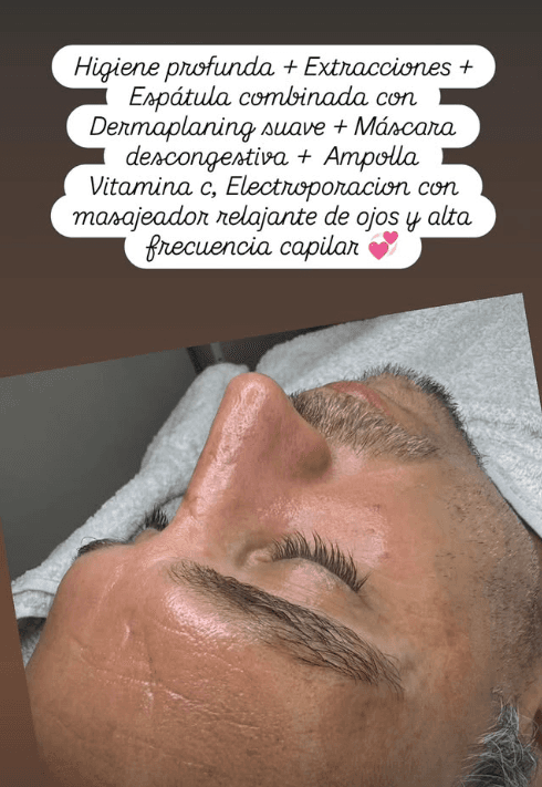 Higiene profunda facial con extracciones, máscara y electroporación